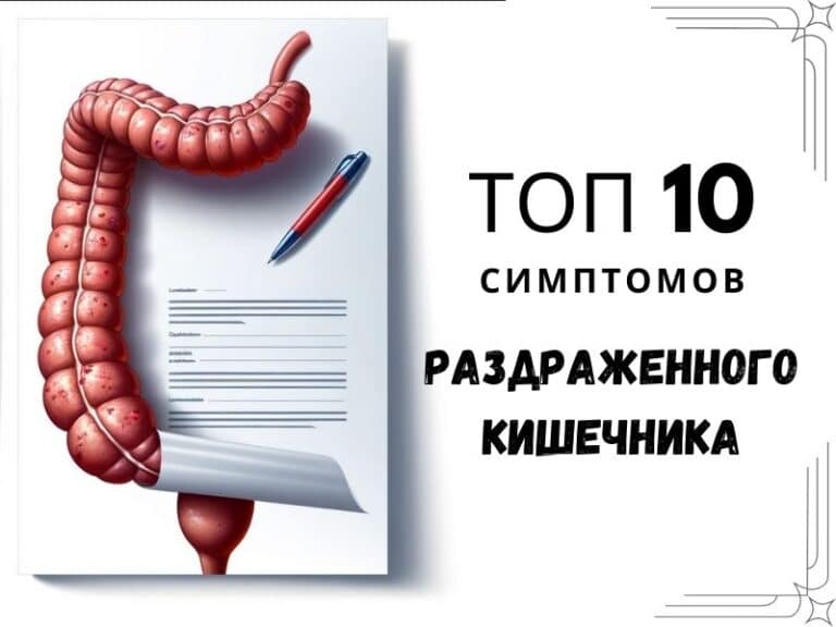 Топ 10 симптомов раздраженного кишечника (СРК)